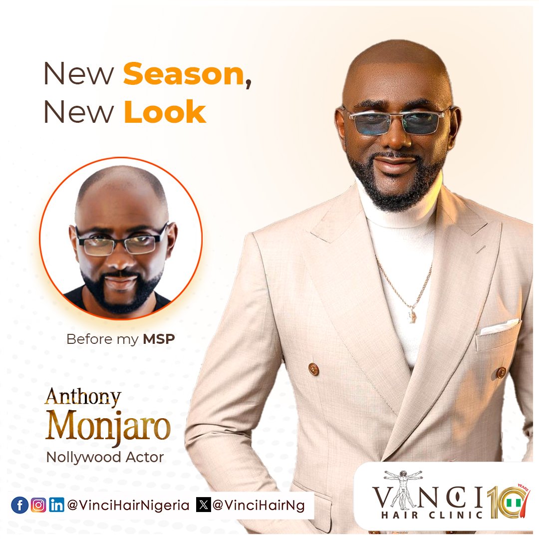 VinciHairNG's tweet image. New Season, New Hair! 

See Anthony Monjaro&apos;s amazing transformation on our website. 

Book a FREE consultation at vincihairafrica.com for 10% off your hair treatment.

#MicroScalpPigmentation  #hairtransplantnigeria #hairtransplantlagos #hairlosssolutions #hairlosstreatment