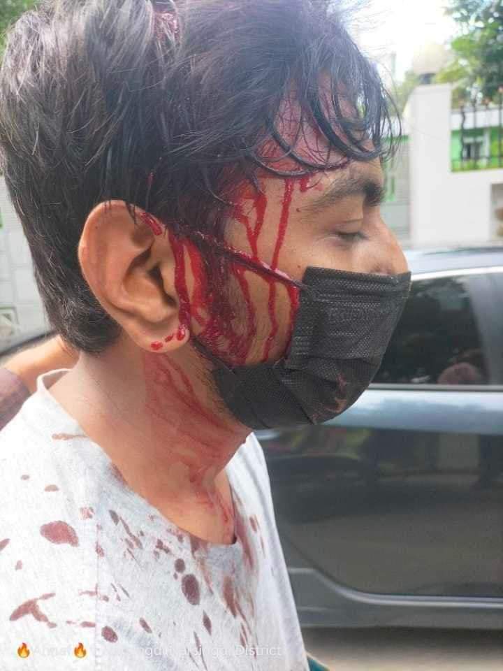 joinwdelower's tweet photo. Narsingdi students are not doing well
#aggressivepolice
#policeattack
#BSLattack
#QuotaReformProtest
#savestudent https://t.co/09AMsiDB8O