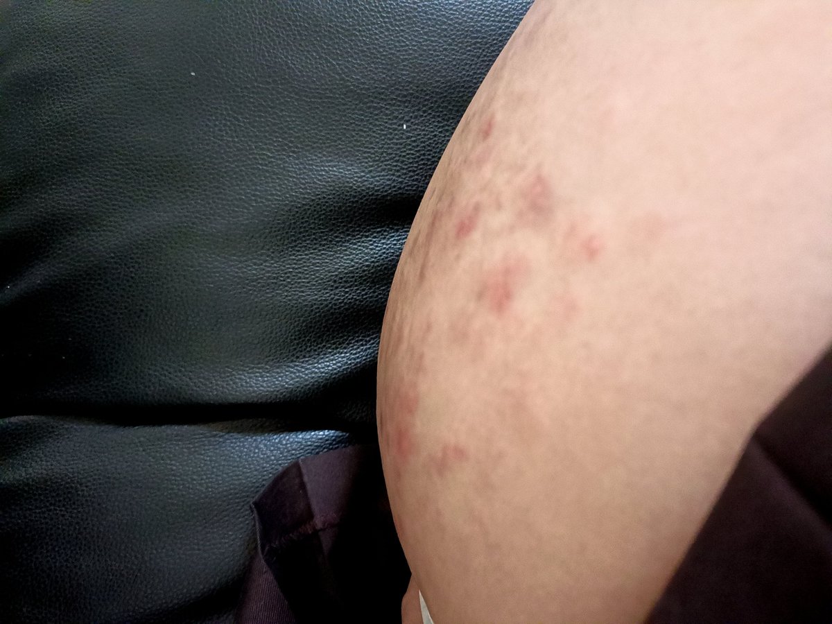 5likespcc's tweet photo. 開花花惹~
#小圈 #女贝 #spanking https://t.co/1hdAI66CbR