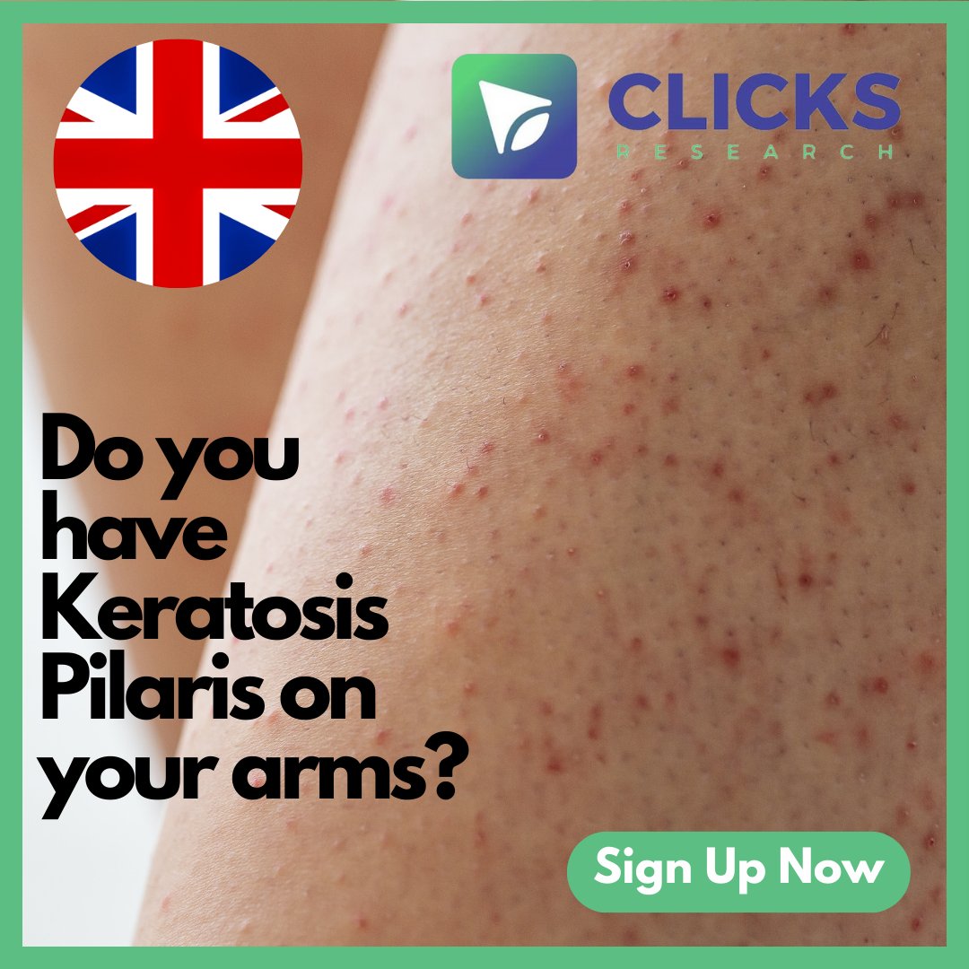 Clicks_Research's tweet photo. VOLUNTEERS LIVING IN THE UK ONLY

Do you have Keratosis Pilaris on your arms?

We want to give you a FREE product to help! All we ask is for your honest opinion.

If you are new, please sign up today at https://t.co/LUb4XLLMSJ. https://t.co/A3t0pP3qhh