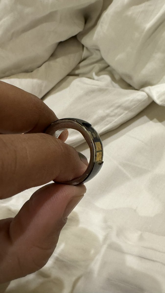 drparthu's tweet photo. so this is what happend to my ring after 8 months.. questionable qulity and pathetic sales service.. the outer surface literally came out in one section and @RockWithboAt ppl say we cant cover it as its physical damage.. https://t.co/xIivcrg33A