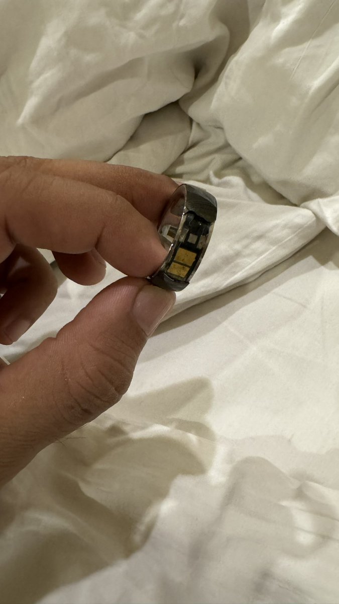 drparthu's tweet photo. so this is what happend to my ring after 8 months.. questionable qulity and pathetic sales service.. the outer surface literally came out in one section and @RockWithboAt ppl say we cant cover it as its physical damage.. https://t.co/xIivcrg33A