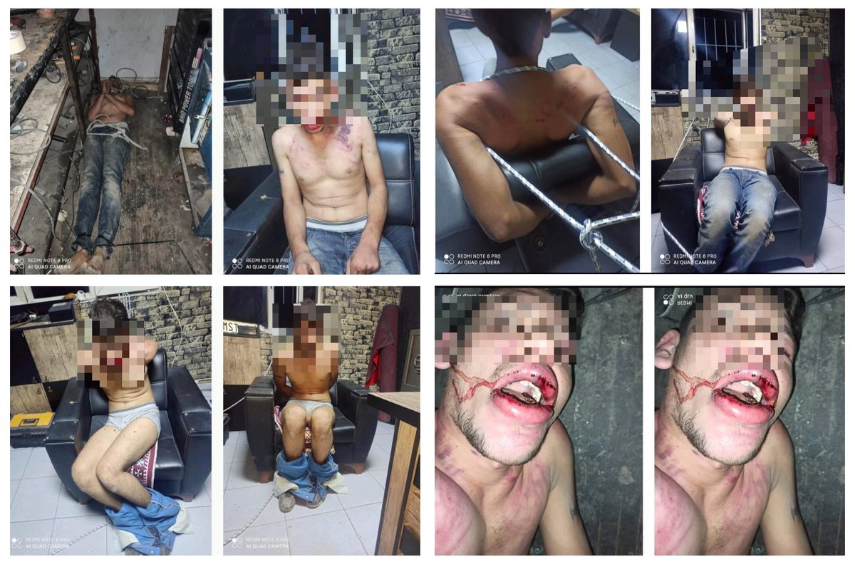 *Antalya'da bir oto bakım atölyesinde çalışırken alamadığı maaşını isteyen 22 yaşındaki genç işçi Vedat Kurt'a patronları tarafından 3 ay boyunca işkence edildi..
v/<a href="/mehmetyetim63/">Mehmet Yetim</a>