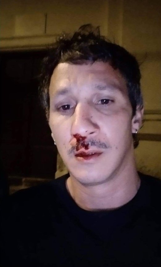 datesLGBT's tweet photo. 15/07/2021 ❌ À #Macinaggio/#Rogliano (Corse), dans un bar la nuit du 14 au 15, une vingtaine d’hommes (principalement des mineurs) agressent verbalement & physiquement un couple d’hommes en raison de leur orientation sexuelle. Les blessures valent 6 & 8 jours d’ITT aux victimes. https://t.co/SPTWclTtQK