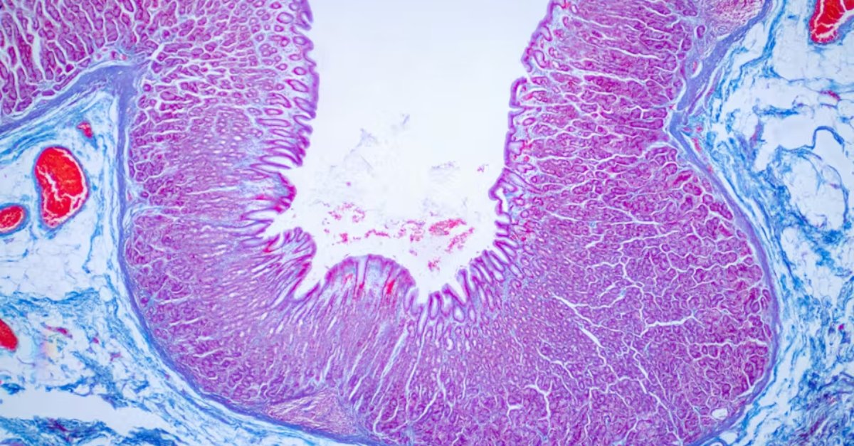 GuardantHealth's tweet photo. The urgent need for new #ColorectalCancer screening options is highlighted in a recent article by @DrLen for @HCInnovationGrp. As we work towards improved patient outcomes and accessibility, it is essential to explore innovative approaches.