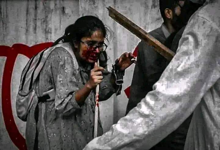 Lamiya_Himi's tweet photo. Already(Bangladeshi students)five students have been killed and approximately 100,000 students have been injured. We demand justice for this. #Save_Bangladeshi_Students #StudentsUnderAttack #QuotaReform #QuotaReformProtest #Bangladesh #DhakaUniversityUnderAttack #QuotaMovement https://t.co/m36L7w6RrI