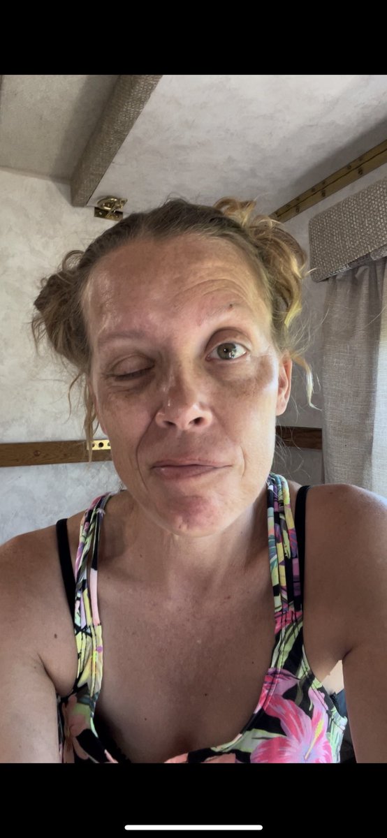 CarrieSak's tweet photo. Today I stand as a testament to the risks of the COVID-19 Vax. My life has been forever altered by its consequences. With your support I can fight for Justice against the Canadian gov. Seeking accountability and ensuring that others don’t suffer the same way. https://t.co/9gcsHUiEE0