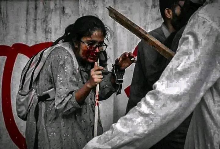 Roich400's tweet photo. কিছু বলার ভাষা নাই💔💔💔

#Save_Bangladeshi_students
#ALjazerra
#Bbcnews #CNN #TheWashingtonPost
#TheNewYorkTimes #TheGuardian
#BBC #AlJazeeraEnglish #TheWallStreetJournal
#CNBC #DhruvRathee #UnitedNations #NewYorkTimesOpinion
#ABCNews #NewYorkPost #ProjectNightfall
#AbhiandNiyu https://t.co/9JNwbVtFmq