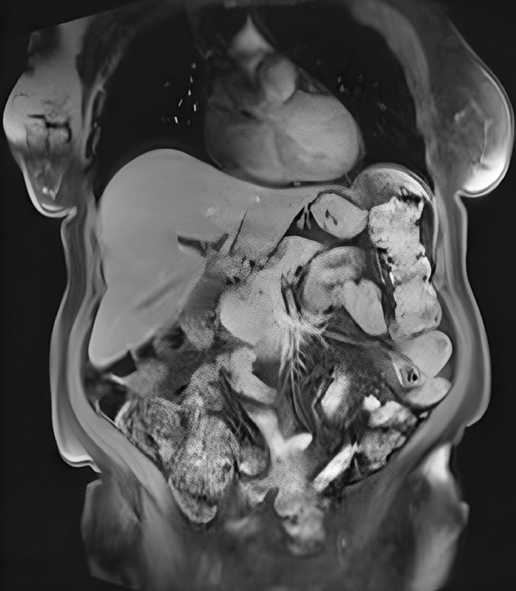 Endoscopy Journal tweet media