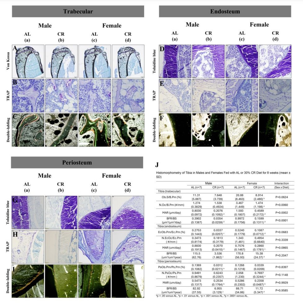 New manuscript alert from Rosen lab postdoc Dr. Linyi Liu! Calorie restriction impaired bone mass &amp; increased accumulation of bone marrow adipose tissue. CR may shift the differentiation of bone marrow stem cells towards adipocytes instead of osteoblasts doi.org/10.1093/jbmr/z…