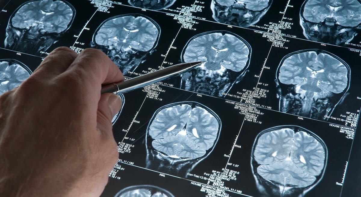 Cómo predecir el #Alzheimer con #inteligenciaartificial en personas con problemas de memoria. 
El modelo de #aprendizajeautomático identificó correctamente a las personas que desarrollaron Alzheimer en el 82% de los casos 
eleconomista.es/tecnologia/not…