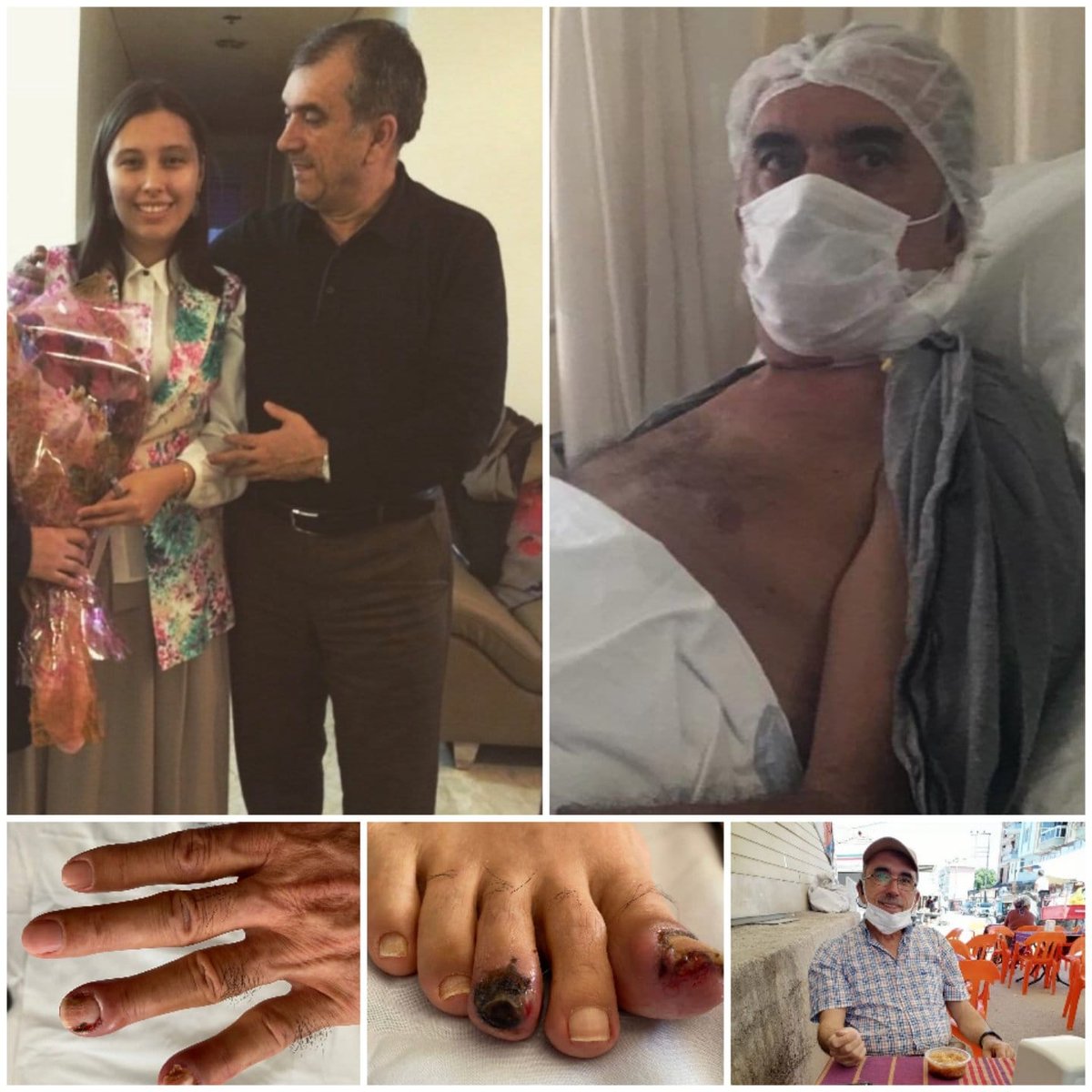 Hastalr_Tutuklu's tweet photo. GEÇ GELEN ADALET FAYDA ETMEDİ

Cezaevinde 4. evre akciğer kanserine yakalanan, tedaviye hapiste 1 yıla yakın ulaşamayan ve geç tahliye edilen Ahmet Zeki Özkan tedavi gördüğü hastanede bugün VEFAT ETTİ. @adalet_bakanlik 

Mekanı cennet olsun, başımız sağ olsun. https://t.co/Mu00k7PuCU
