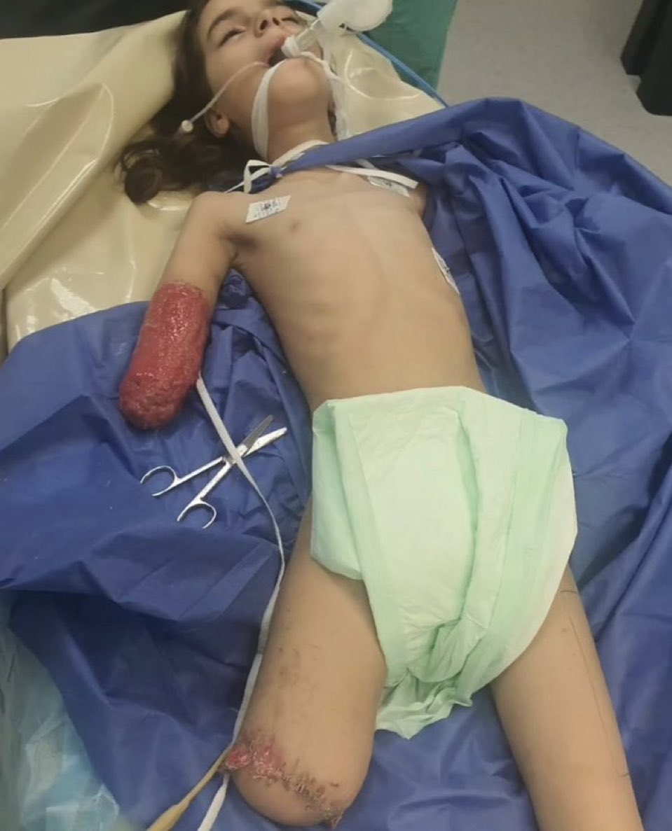 Afcq1954's tweet image. محتوى حساس وقاسي🔞🔞

حتى لا يأتي أحد يوم القيامة ويقول

يا رب لم أكن أعلم هذا ما حدث للأطفال