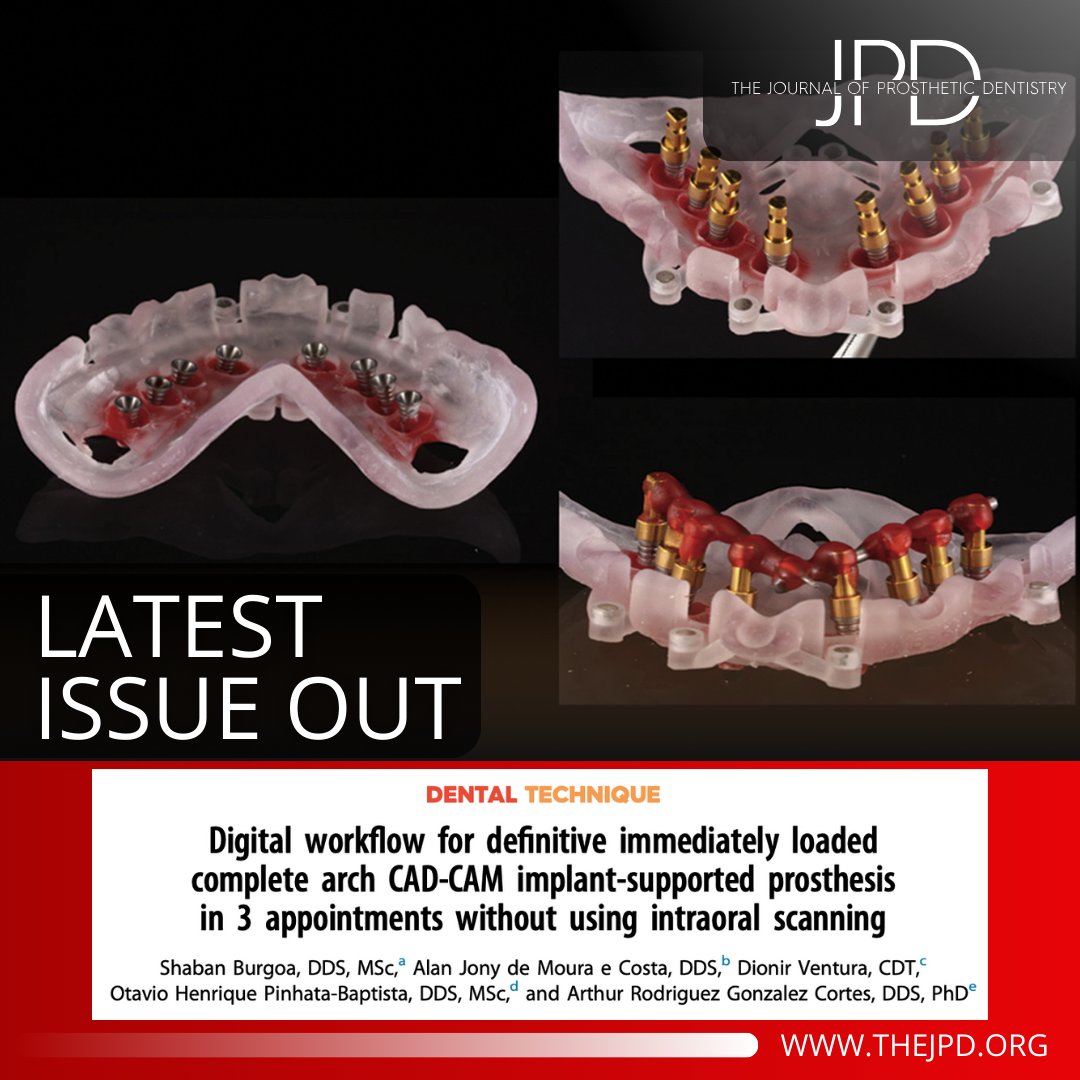 JPDentistry's tweet photo. This article describes the process for digital planning w/ magnet-retained stackable #implant #surgicalguide, completing #implantsurgery, & manufacturing #dentalimplant complete arch #fixeddentalprosthesis to complete the treatment plan in 3 appointments: https://t.co/yb5coObpPH https://t.co/1augpE3S6X