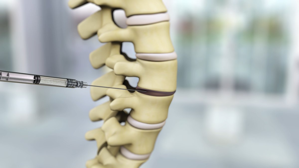 Congrats to <a href="/DiscGenics/">DiscGenics</a> for announcing the FDA has allowed Phase III clinical evaluation of their allogeneic, injectable disc progenitor cell therapy for painful lumbar #degenerativediscdisease to proceed. Link below for details. #UtahLifeSciences

ow.ly/2xlM50SCGE7