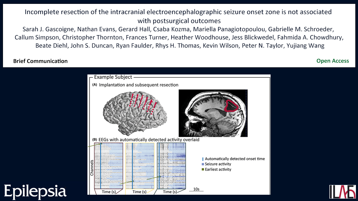 Epilepsia (@epilepsiajourn) on Twitter photo Incomplete resection of the intracranial electroencephalographic seizure onset zone is not associated with postsurgical outcomes
doi.org/10.1111/epi.18…
#epilepsy #ILAE #epilepsysurgery #intracranialEEG #onsetdetection #seizurefreedom <a href="/IlaeWeb/">International League Against Epilepsy</a> @epilepsiajourn <a href="/WileyNeuro/">Wiley Neuro</a> Incomplete resection of the intracranial electroencephalographic seizure onset zone is not associated with postsurgical outcomes
doi.org/10.1111/epi.18…
#epilepsy #ILAE #epilepsysurgery #intracranialEEG #onsetdetection #seizurefreedom <a href="/IlaeWeb/">International League Against Epilepsy</a> @epilepsiajourn <a href="/WileyNeuro/">Wiley Neuro</a>