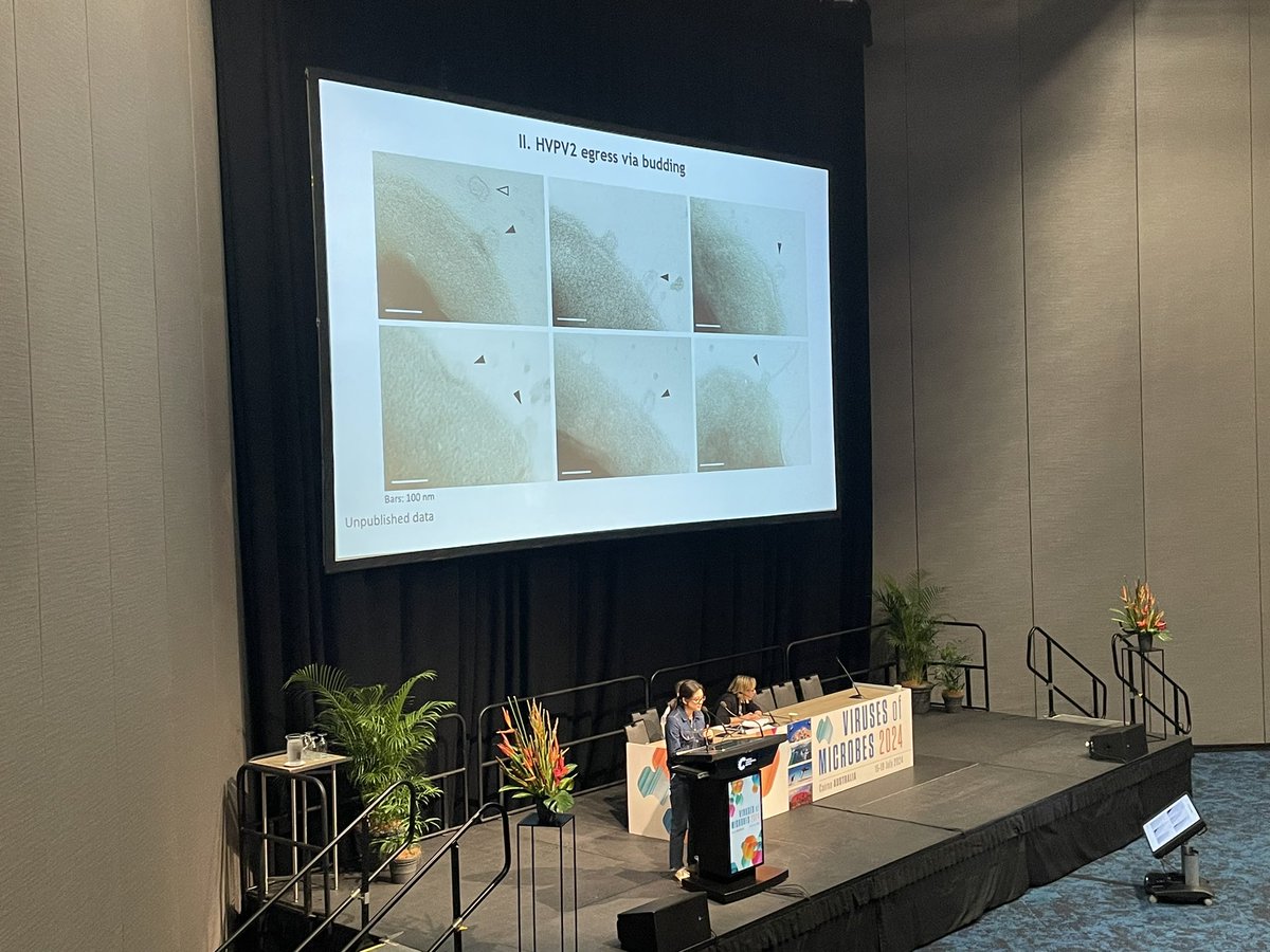VirusOfMicrobes's tweet photo. And now Yong Liu (@yingliu_virus) from Wuhan University about  #HVPV2 virus budding from #Haloferax volcanii. https://t.co/9wAIPExHP2