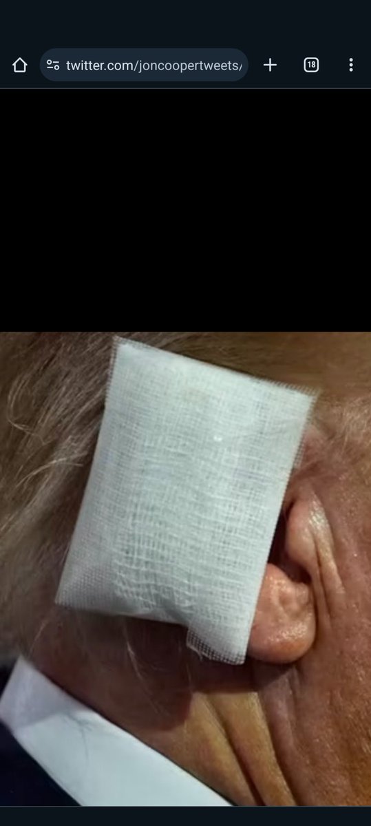AricCampling's tweet photo. @HeyNurseKat @Jagr707 It's definitely a gauze square or two held together with transpore tape. https://t.co/NRqSHPQ2zF