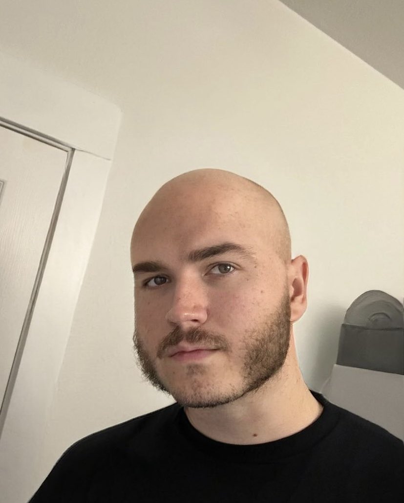 SKREWUGUYZ's tweet photo. afternoon chat #real #baldmansworld #andyourelivinginit #bringbackmasculinity #baldisbetter #cleandomekingdom #actuallybald #betacuckhairgrowers https://t.co/zZA44vFHHQ