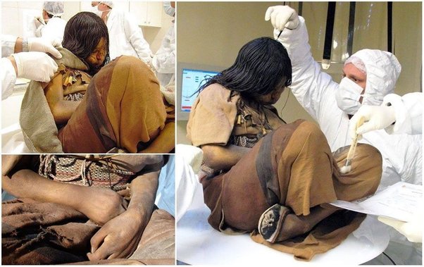 This 15-year-old girl lived in the Inca empire and was sacrificed 500 years ago as an offering to the gods.  

She is preserved this well because she was frozen during sleep and kept in a dry cold condition at more than 6000 meters above sea level all this time. No other