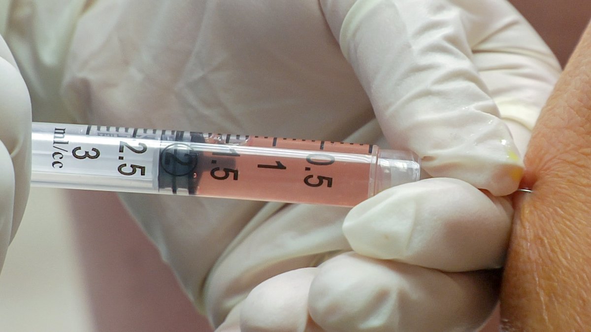 Regenerative Medicine. It's an amazing pitch. Let's harness your bodies own cells - stem cells no less - to heal what ails you. Worldwide, harvesting cells from one part of your body and injecting them into another is a 35 BILLION dollar industry. But is it, you know, real?
(🧵)