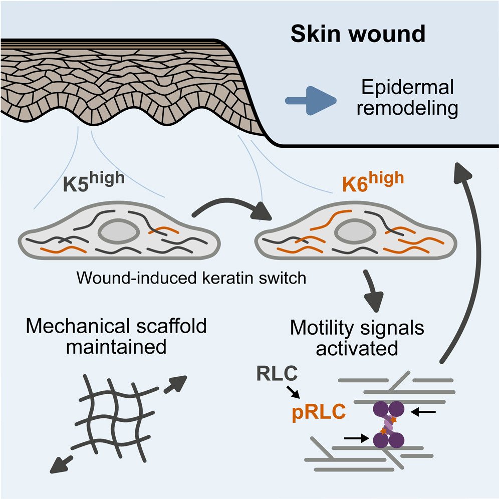 Dermal Cell News (@dermalcell) on Twitter photo During skin #WoundHealing, the isoform composition of keratin filaments changes. 💡
Drs. <a href="/BenjaminNanes/">Benjamin Nanes</a>, Gaudenz Danuser (<a href="/DanuserLab/">Danuser Lab</a>) and co. report an unexpected effect of keratin isoform variation on kinase signal transduction. <a href="/Dev_Cell/">Developmental Cell</a>
Learn more: bit.ly/3zLu114 During skin #WoundHealing, the isoform composition of keratin filaments changes. 💡
Drs. <a href="/BenjaminNanes/">Benjamin Nanes</a>, Gaudenz Danuser (<a href="/DanuserLab/">Danuser Lab</a>) and co. report an unexpected effect of keratin isoform variation on kinase signal transduction. <a href="/Dev_Cell/">Developmental Cell</a>
Learn more: bit.ly/3zLu114