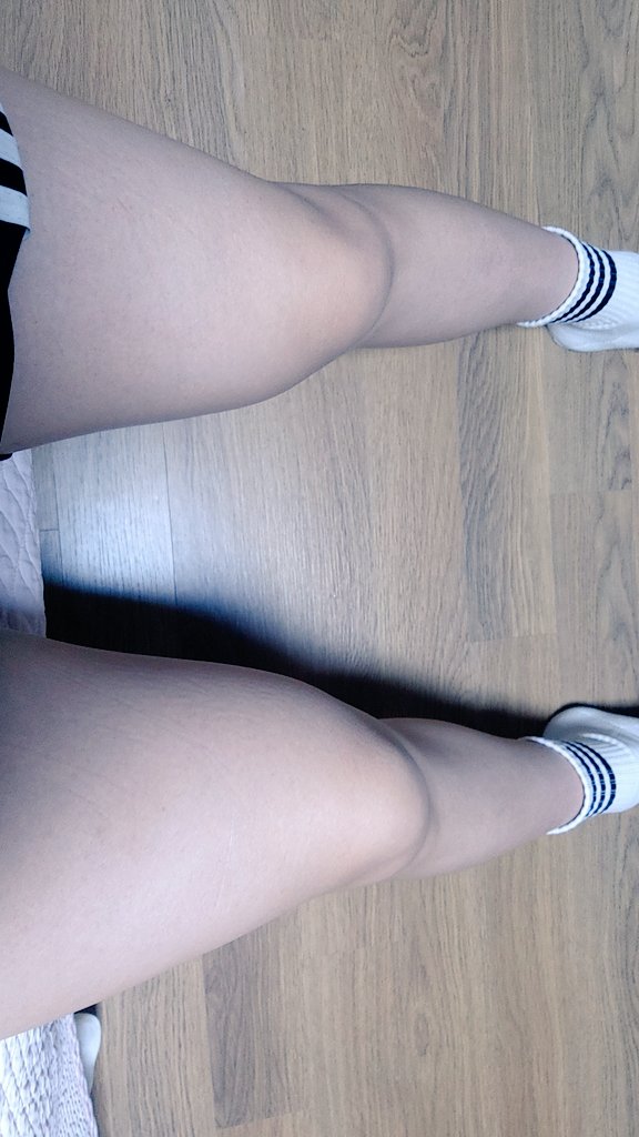 운동러의 다리!😤(힘안준거이심)
오랜만에 반바지 입으니까 세상 너무시원하고 편안하다ㅜ