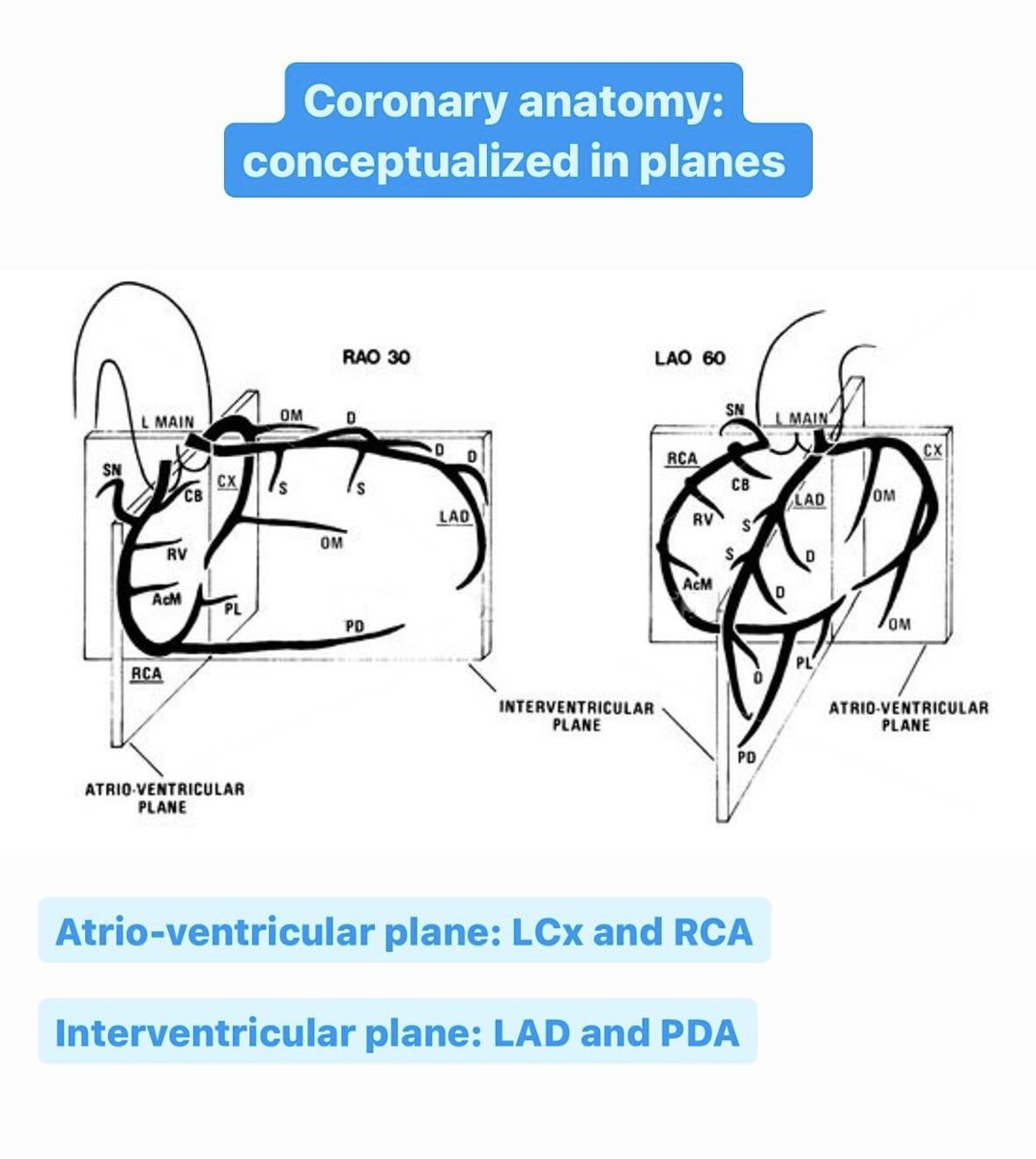 #JulySeries part 6 📚

Coronary anatomy – easier to understand when conceptualized in planes 

🔹Atrio-ventricular plane: LCx and RCA

🔹Interventricular plane: LAD and PDA