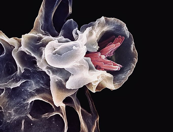 Encyclopedia_X's tweet photo. 🦠A macrophage is shown engulfing rod-shaped tuberculosis bacteria, demonstrating its crucial role in immune defense. 
🖼️More images: https://t.co/nYiuNVNUpr
#Macrophage #tuberculosis #bacteria https://t.co/gNHNgle5DL