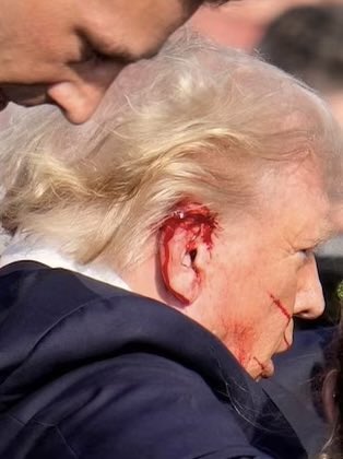 emmabruzer's tweet photo. @TheEcho13 @joncoopertweets I mean, I'm no medical expert, but that doesn't look like a through-and-through https://t.co/GqoOKX6HLM