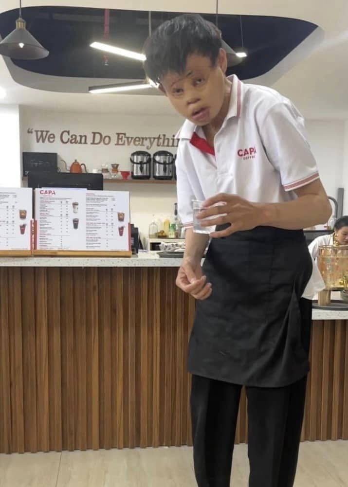ccabradilla94's tweet photo. “This young man came to work as a waiter to earn money for his mother's medical treatment. Initially, he was afraid to serve coffee because he was self-conscious about his appearance, but I called him over and told him it was okay. He did a commendable job."

C: Tracy Truong https://t.co/8KbDhs5Epg
