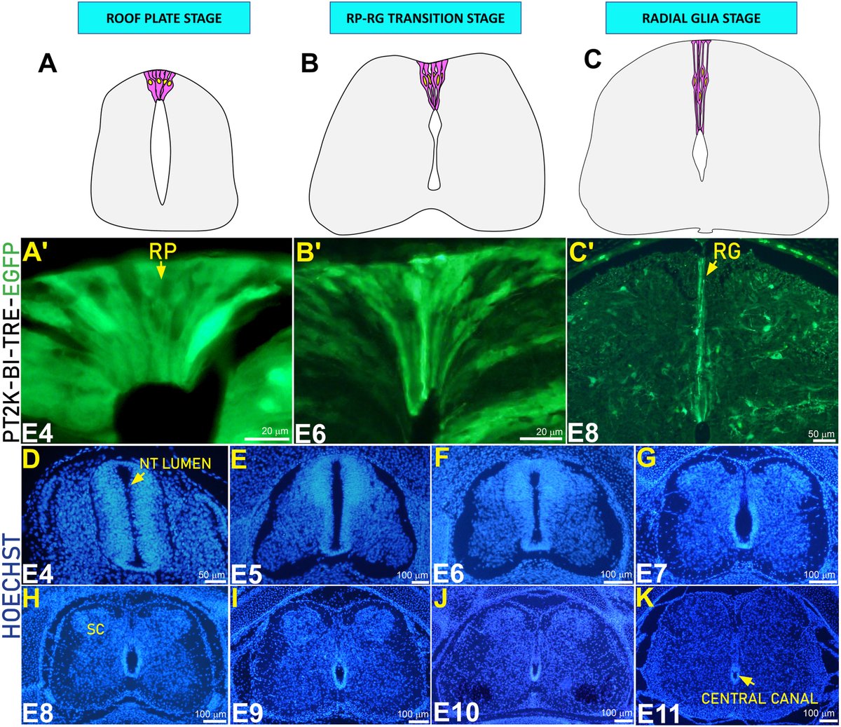 Developmental Biology (@dev_bio_journal) on Twitter photo #DBfeature
From neural tube to spinal cord: The dynamic journey of the dorsal neuroepithelium
by Susanna Ventriglia, Chaya Kalcheim <a href="/susanna_ventrix/">susanna ventriglia</a> <a href="/ChayaKalcheim/">Chaya Kalcheim</a>
sciencedirect.com/science/articl… #DBfeature
From neural tube to spinal cord: The dynamic journey of the dorsal neuroepithelium
by Susanna Ventriglia, Chaya Kalcheim <a href="/susanna_ventrix/">susanna ventriglia</a> <a href="/ChayaKalcheim/">Chaya Kalcheim</a>
sciencedirect.com/science/articl…