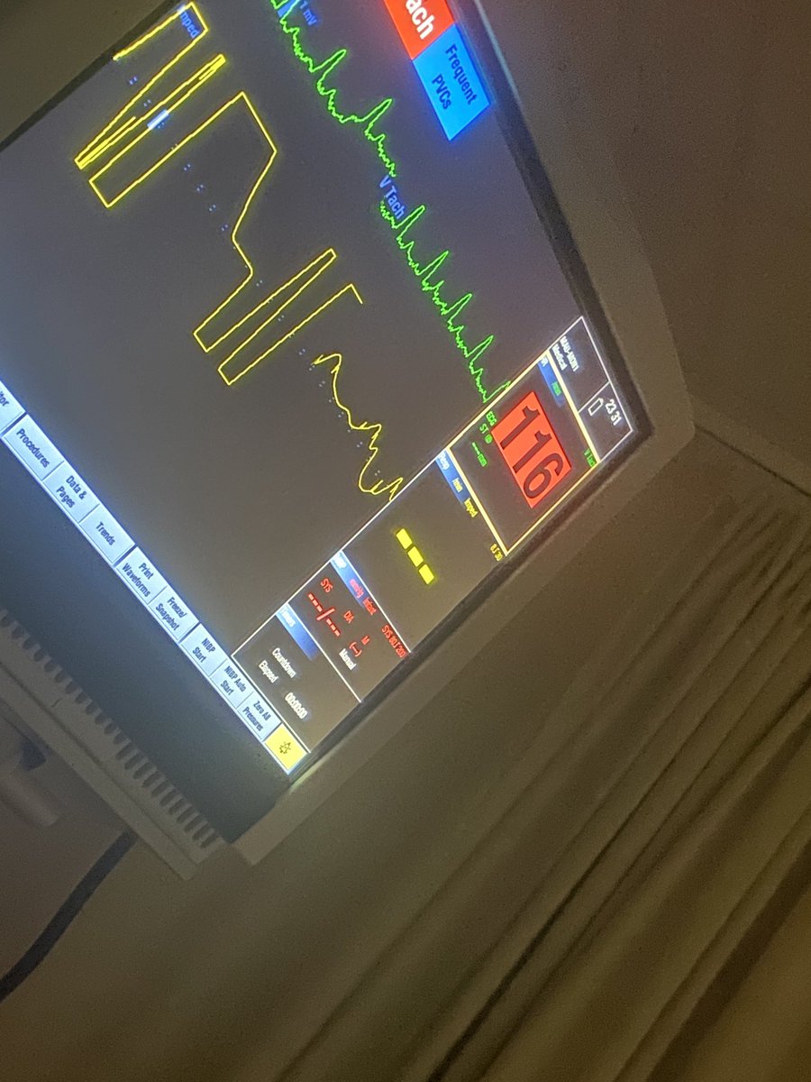 _MARC3L1NE's tweet photo. The nhs is in shambles. I have been in the hospital for 5 days. They diagnosed me with POTS yesterday and are now taking that back and having to do more tests and different meds. I just want to be better. Been constricted hooked up to monitors this whole time. I want to be ok https://t.co/MVr6r7wLIT