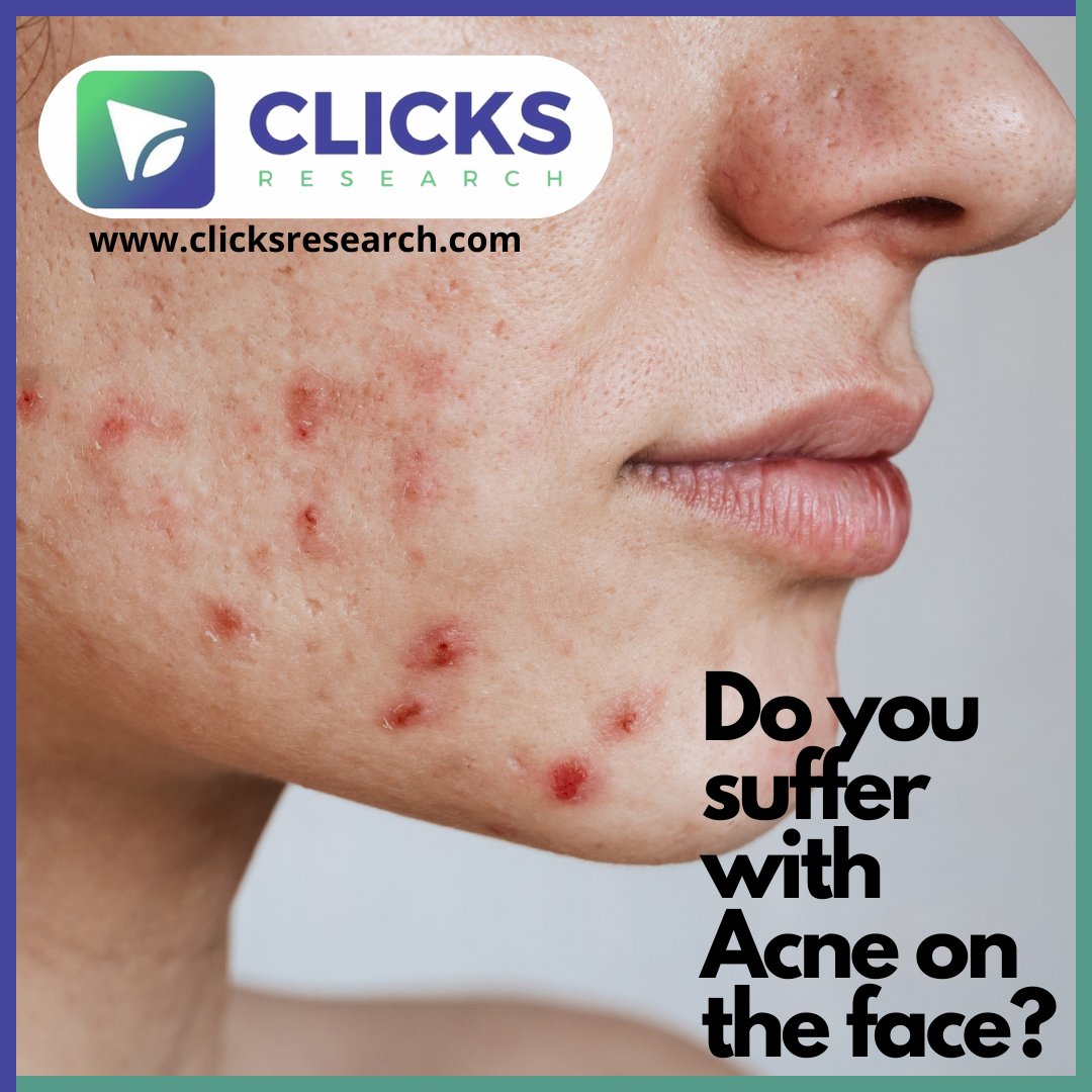 Clicks_Research's tweet photo. ✨UK VOLUNTEERS ONLY ✨

Do you have acne on the face?

We are currently recruiting volunteers living in the UK to trial a Acne Serum.

If you meet the below criteria, please sign up today at https://t.co/LUb4XLMkIh and complete your profile questions.

Clicks Research 💜 https://t.co/11IrpBcLDc