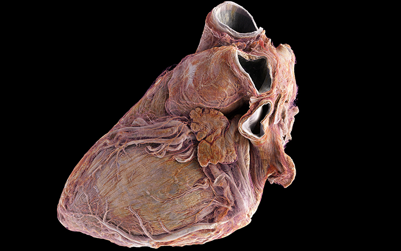 UCL News (@uclnews) on Twitter photo Two whole adult human hearts have been imaged in unprecedented detail by researchers including Prof Peter Lee, Dr Joseph Brunet <a href="/uclmecheng/">UCL MechEng</a> and Prof Andrew Cook <a href="/UCL_ICS/">UCL Institute of Cardiovascular Science</a>, in collaboration with <a href="/esrfsynchrotron/">European Synchrotron</a>
ucl.ac.uk/news/2024/jul/… Two whole adult human hearts have been imaged in unprecedented detail by researchers including Prof Peter Lee, Dr Joseph Brunet <a href="/uclmecheng/">UCL MechEng</a> and Prof Andrew Cook <a href="/UCL_ICS/">UCL Institute of Cardiovascular Science</a>, in collaboration with <a href="/esrfsynchrotron/">European Synchrotron</a>
ucl.ac.uk/news/2024/jul/…