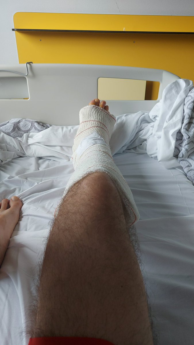 EnzoCocozza's tweet photo. Happy summer everyone, bi-malleolar ankle fracture in self defense 🤕
Stay positive 🫡

￼ https://t.co/XsMIgf9SzB