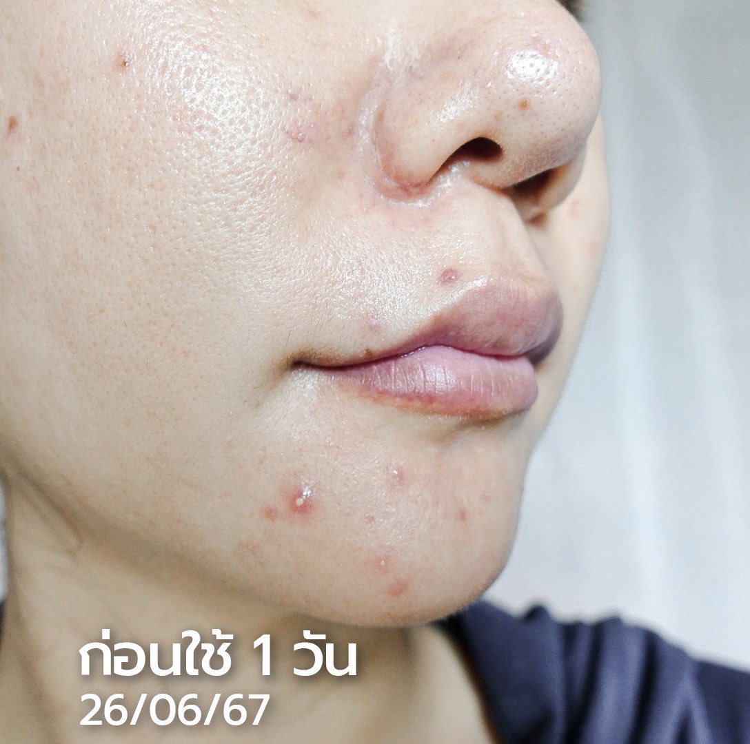 สะไบศรี...รีวิว 🌿 tweet media