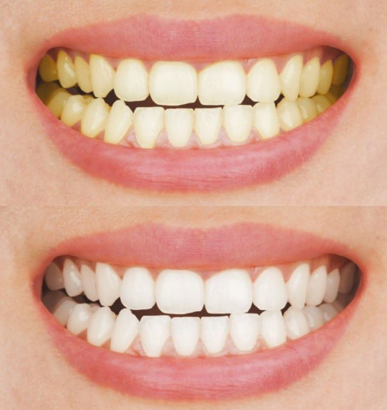 𝙍𝙞𝙪 🏹🤍 tweet media