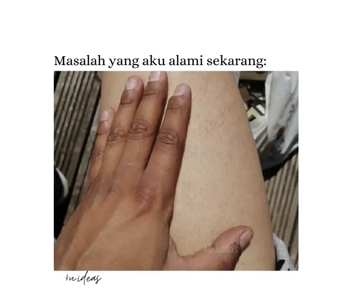 teman_ceritaaa's tweet photo. Masalah yg kalian hadapi apa ? https://t.co/yuYdCScy5O