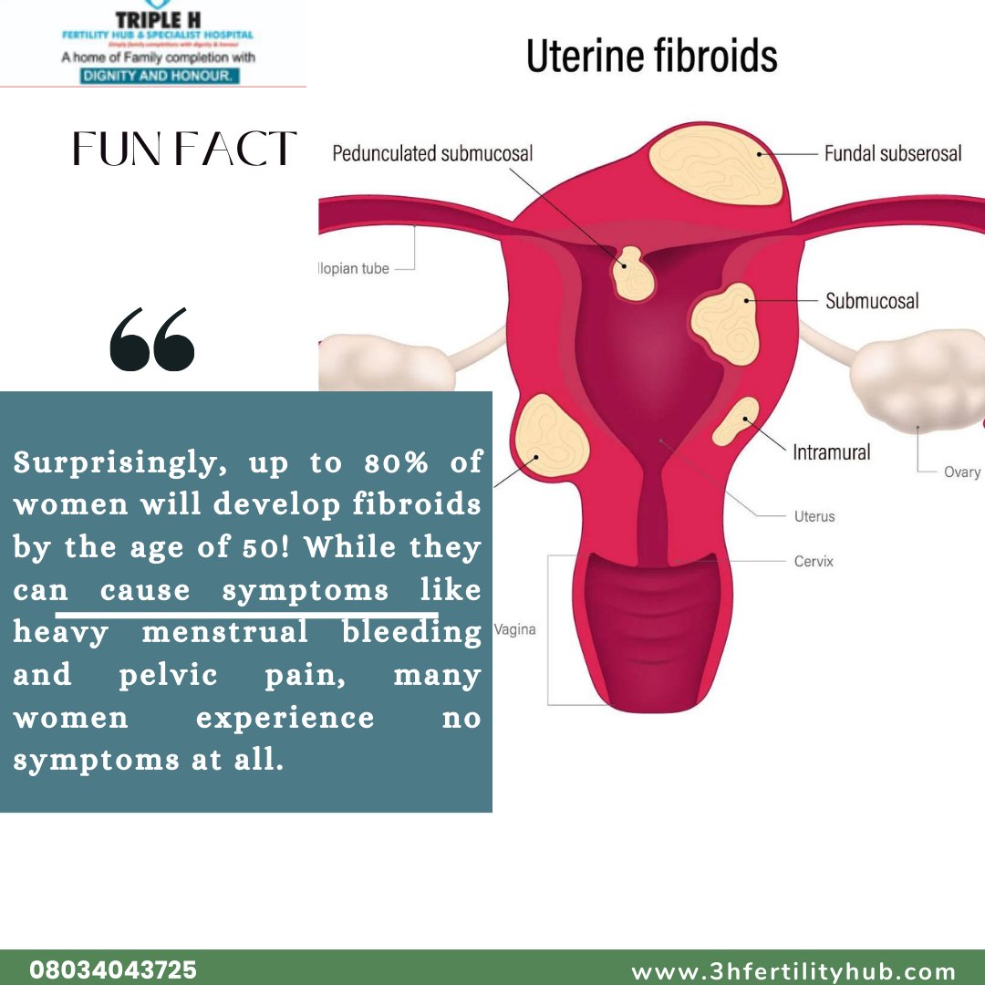 3hfertilityhub's tweet photo. Did you know that most women will develop fibroids by the age of 50?
 Stay informed about this common condition and speak with your healthcare provider for personalized treatment options. 
#FibroidFact #WomensHealth #Apology #triplehfertilityhub https://t.co/4YePtxfX7J