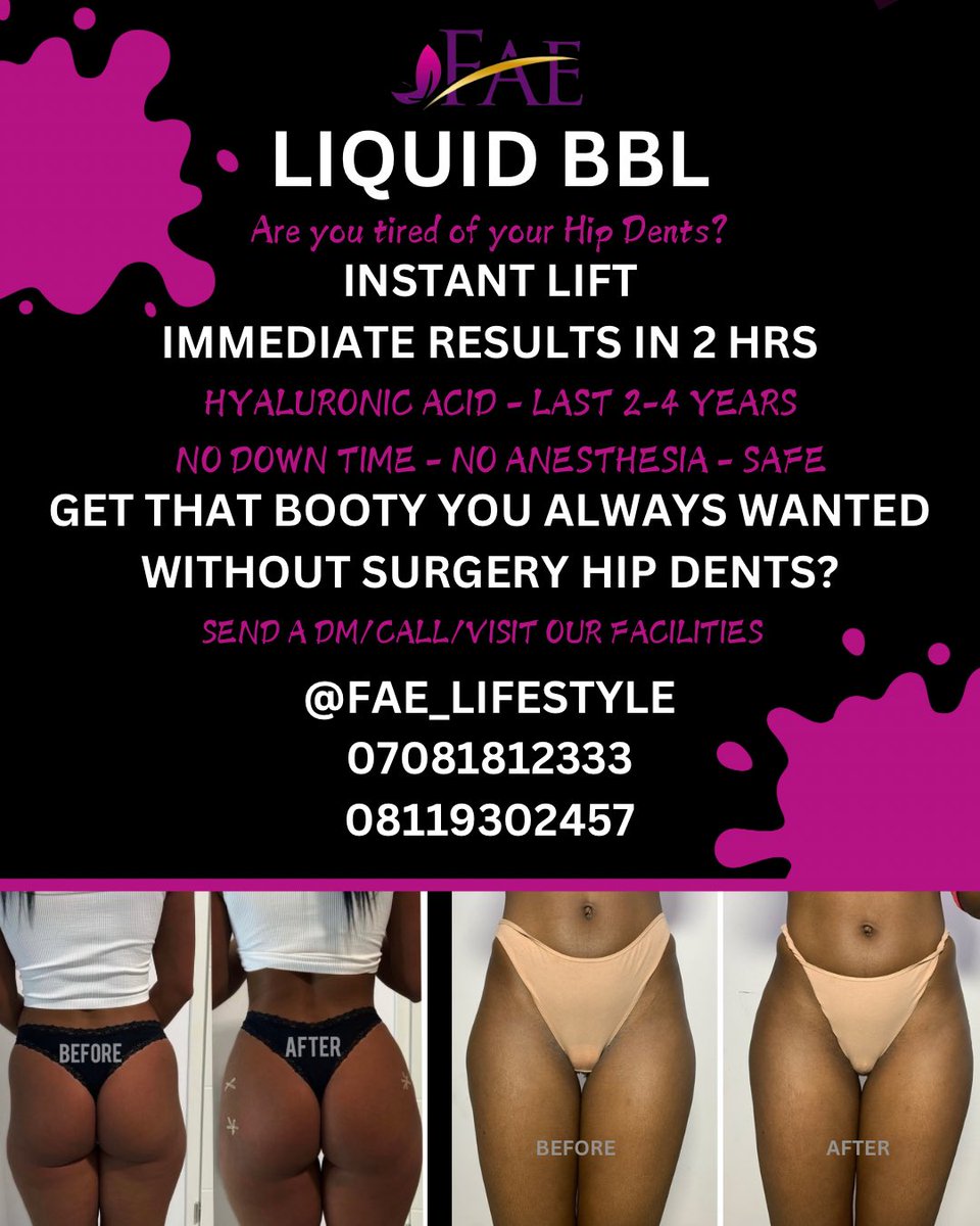 FaeLifestyle's tweet photo. Tired of hip dips snitching?
Come to us!
Want a bigger round butt?
Come to us!

Using HA filler we’ve got you covered.
No downtime, No anesthesia, No surgery.
Visit our offices at Abuja and Lagos, Call:08119302457 
#buttenlargement #hipenlargement #faelifestyle #slimthick https://t.co/4lMbK7r5PB
