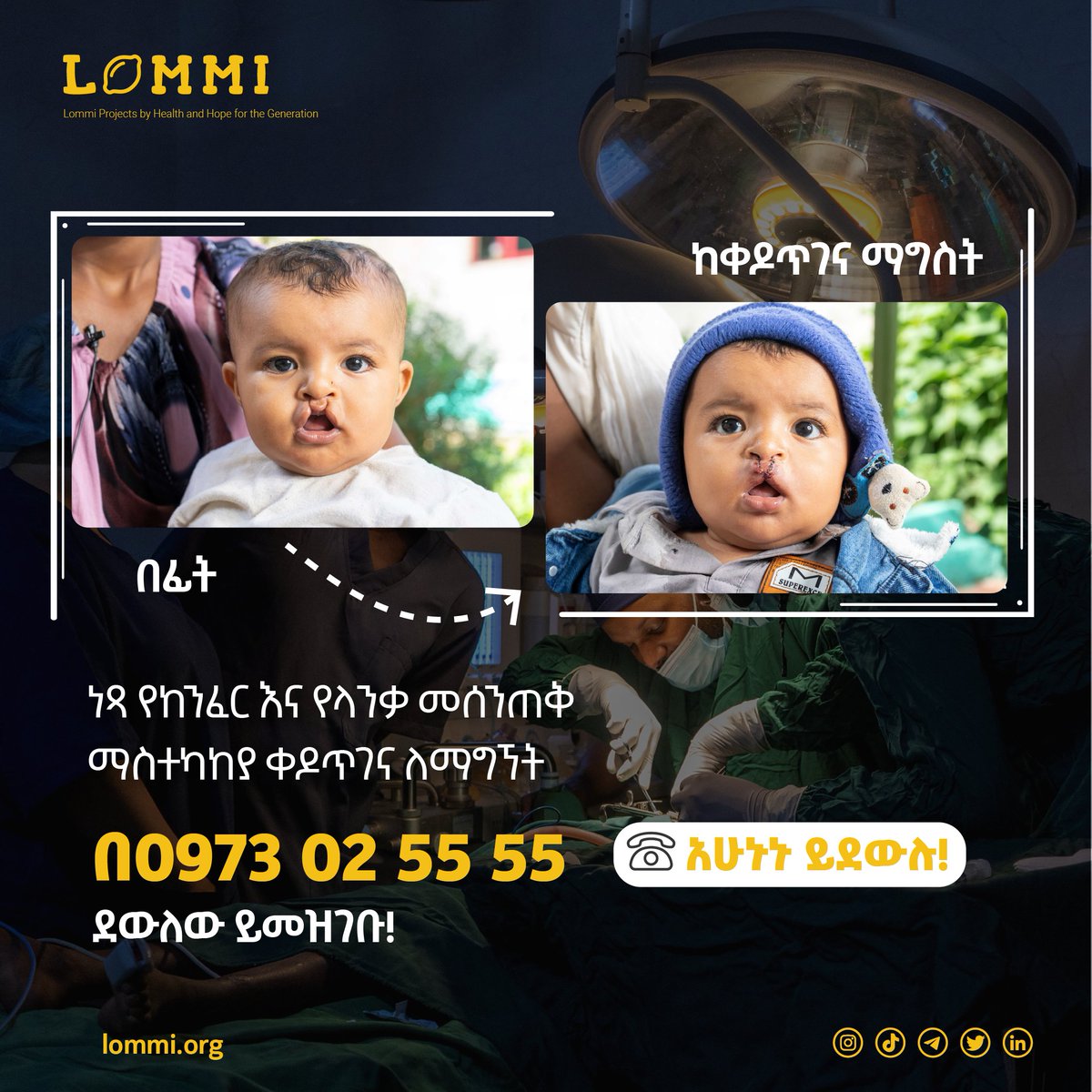 ነፃ የከንፈር እና የላንቃ መሰንጠቅ ማተክከያ ቀዶጥገና በሰግለን ዋጂ አጠቃላይ ሆስፒታል ለማግኘት አሁኑኑ ደውለው ይመዝገቡ!

ለመመዝገብ☎️☎️☎️ 0973025555 ላይ ይደወሉ!

🍋 🍋 🍋
lommi.org