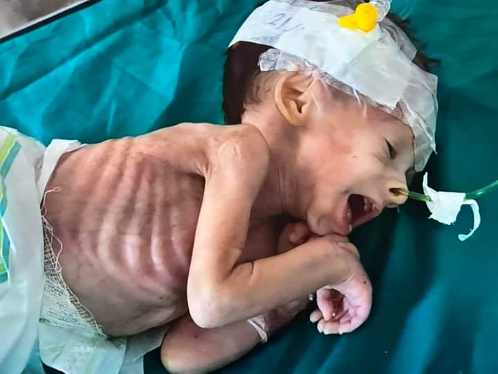 SH1JUI's tweet photo. دل خون کے آنسو رو رہا ہے۔
دن رات سارے منظر سامنے ہوتا ہے۔
اتنا بڑا ظلم دیکھ کر حکمران مسلم کیسے چین سے بیٹھ سکتے ہیں۔
عوام سارے بے چین بے سکون ہیں اور حکمران کیسے پتھر دل ہیں۔حالانکہ 57 مسلم ممالک ہیں۔دنیا کی سب سے بڑی طاقت رکھتی ہے۔پھر بھی ڈرپوک
#IsraelTerroristState
#OicTimid https://t.co/447h2vWA64
