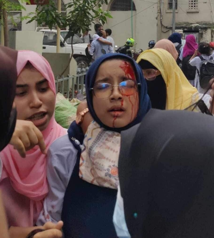 sydmrk007's tweet photo. This is not @gaza.This is our @BANGLADESH🇧🇩
#DhakaUniversityIsUnderAttack #QuotaReform #QuotaMovement #Save_Bangladeshi_students #StudentsUnderAttack #QuotaReformProtestPlease https://t.co/5KFCnzU5bx