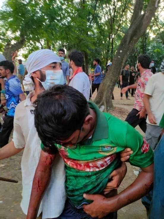 taskifbin's tweet photo. Are we enemies?
Jahangirnagar University
17 July 2024
#QuothaMovement
#QuotaReform
#QuotaProtest https://t.co/HeL12cgfEW