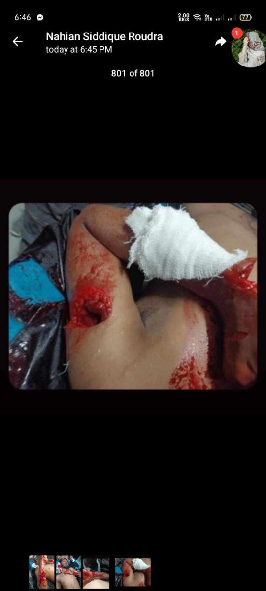 Robin30378339's tweet photo. @AJEnglish Please save Out students 

#Save_Bangladeshi_students 

government Killing our brother and sisters Blindly 

@AJEnglish 

#quota https://t.co/jEXWOy4HbV