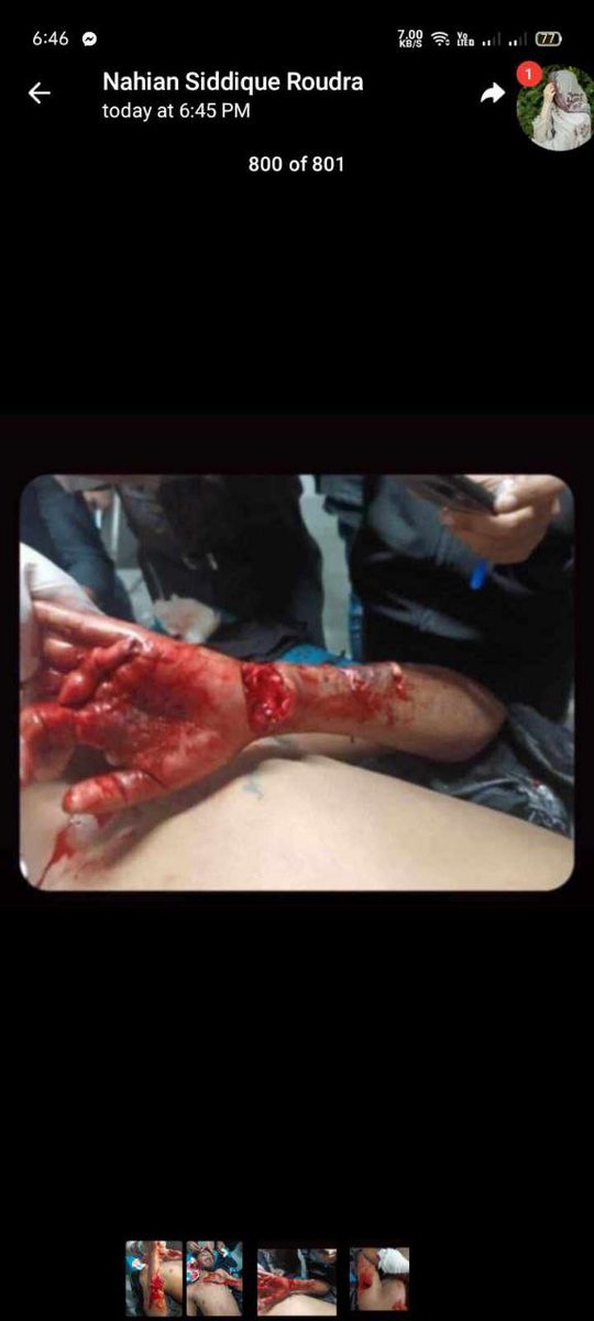 Robin30378339's tweet photo. @AJEnglish Please save Out students 

#Save_Bangladeshi_students 

government Killing our brother and sisters Blindly 

@AJEnglish 

#quota https://t.co/jEXWOy4HbV