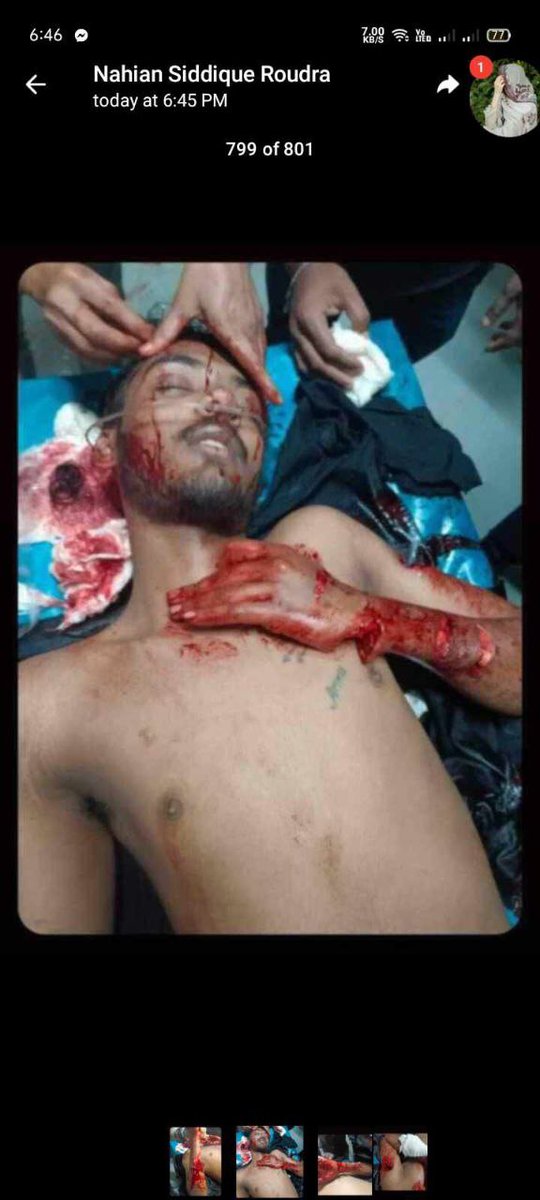 Robin30378339's tweet photo. @AJEnglish Please save Out students 

#Save_Bangladeshi_students 

government Killing our brother and sisters Blindly 

@AJEnglish 

#quota https://t.co/jEXWOy4HbV