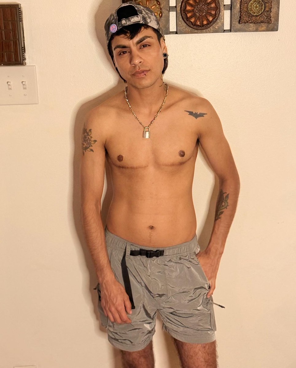 XXXanderJames's tweet photo. Hit my 7 year post op for top surgery this month🏳️‍⚧️🩵 https://t.co/RhWfXvm4dY