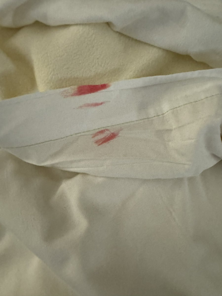 jlal90's tweet photo. @TropicanaAC i stayed at your hotel Saturday and your establishment is shameful. Our room was filthy on check in. Blood on the sheets, feces in the toilet, dirty socks left in the room, and sand all over the floor. Here’s some pics for your proof. Train your staff better https://t.co/eEEmhd5rRX